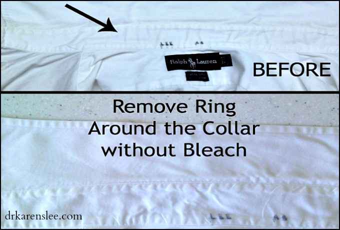 how to remove ring around the collar drkarenslee