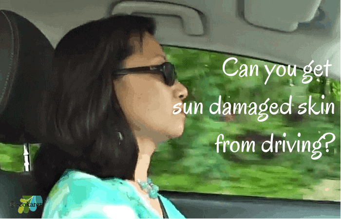 sun damaged skin from driving